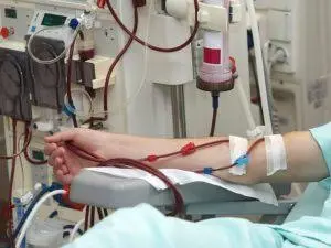 وصلة الدياليز FAV